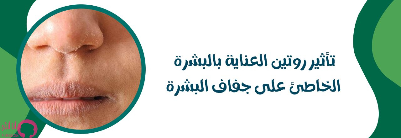 مرطبات البشرة الجافة