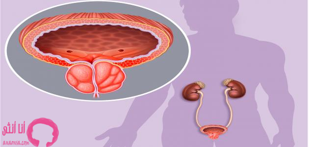 التهابات البروستاتا 