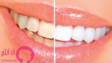 Photo of 5 طرق سهله لـ تبييض الاسنان ( تعرفى عليهم )