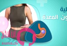 عملية بالون المعدة للتخسيس
