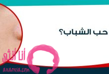 حب الشباب