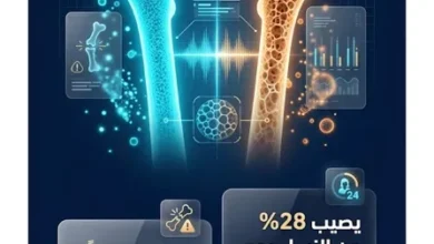 هشاشة العظام بعد سن اليأس